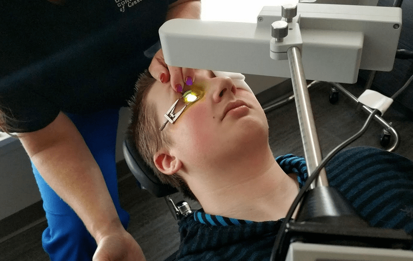 Die Retikulation eliminiert Keratokono zu Beginn ihrer Entwicklung effektiv